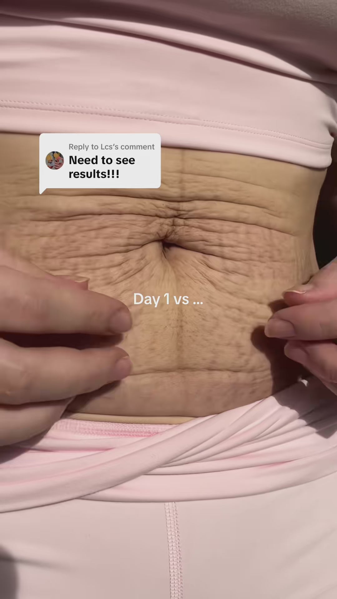 Silkee™BodyCup 1.0